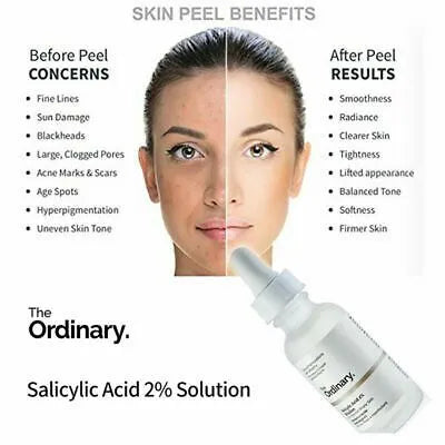 The Ordinary Salicylic Acid 2% Solution (Canadian) - Taha collection